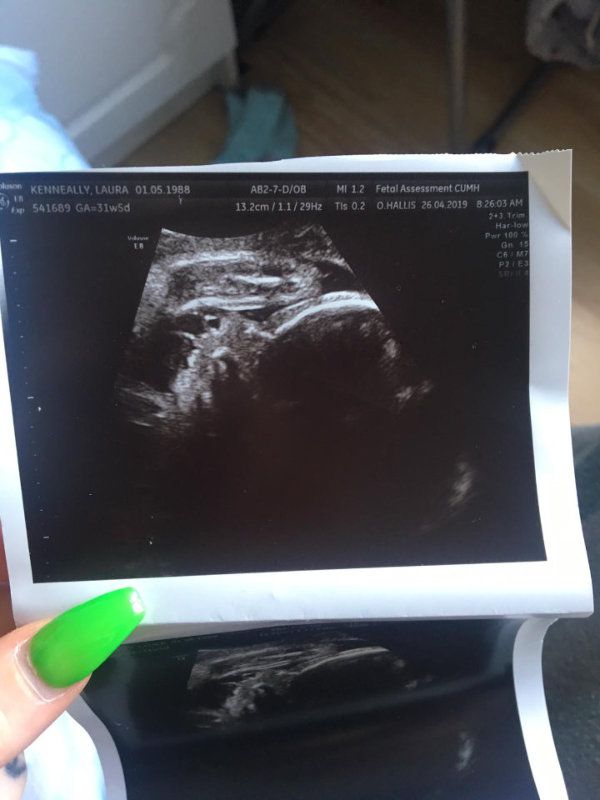 Baby scan